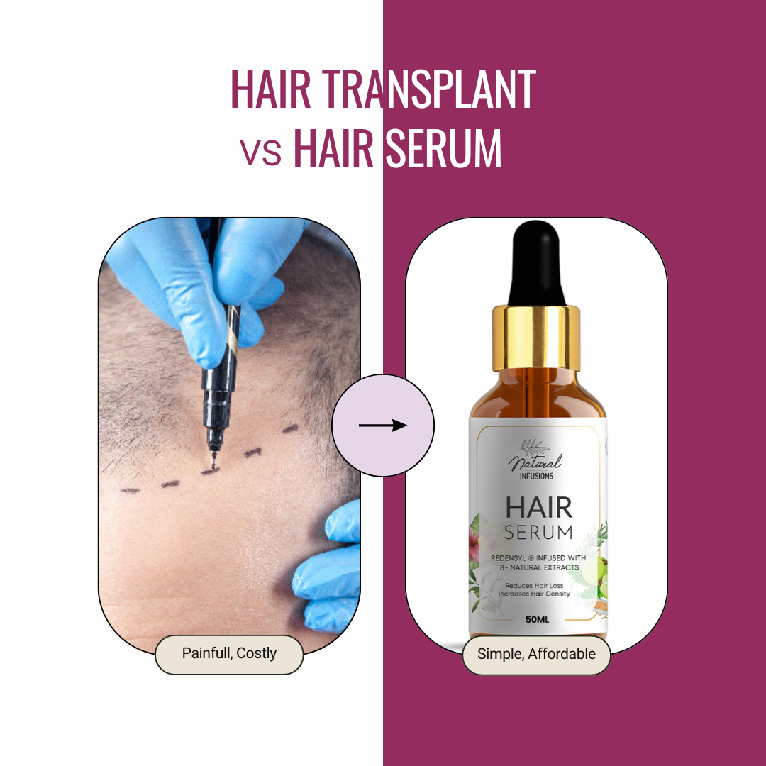 natural infusion hair transplant and hair serum, hair growth