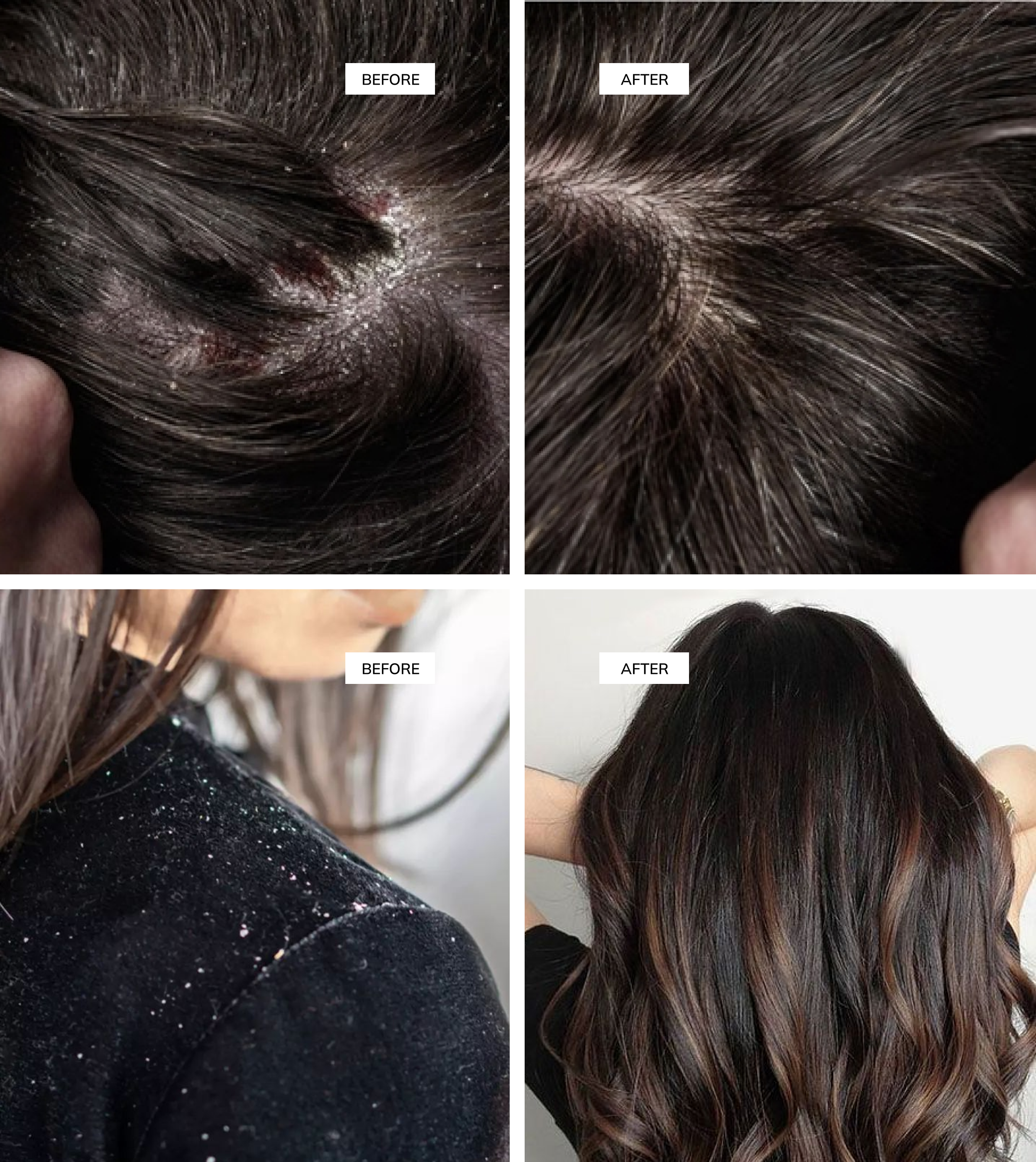 "Before and after results of using hair shampoo for smoother, drandruff free."