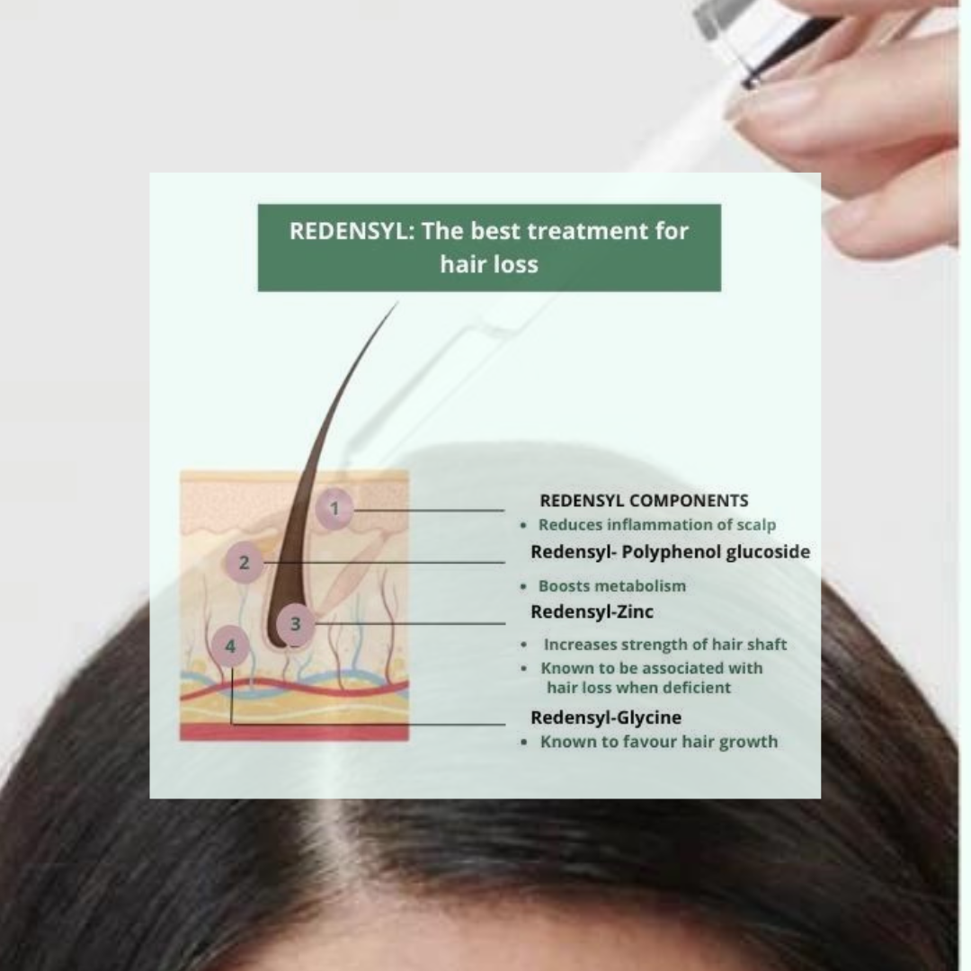 Best Treatment For Hair Loss | Hair Growth Serum | Redensyl |Hair Fall