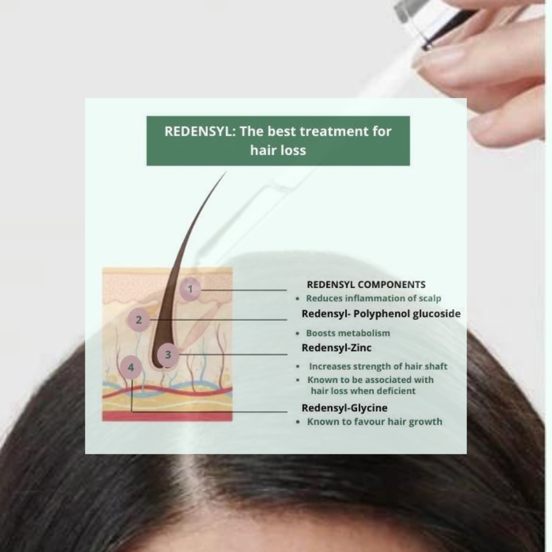 REDENSYL: The best treatment for hair loss