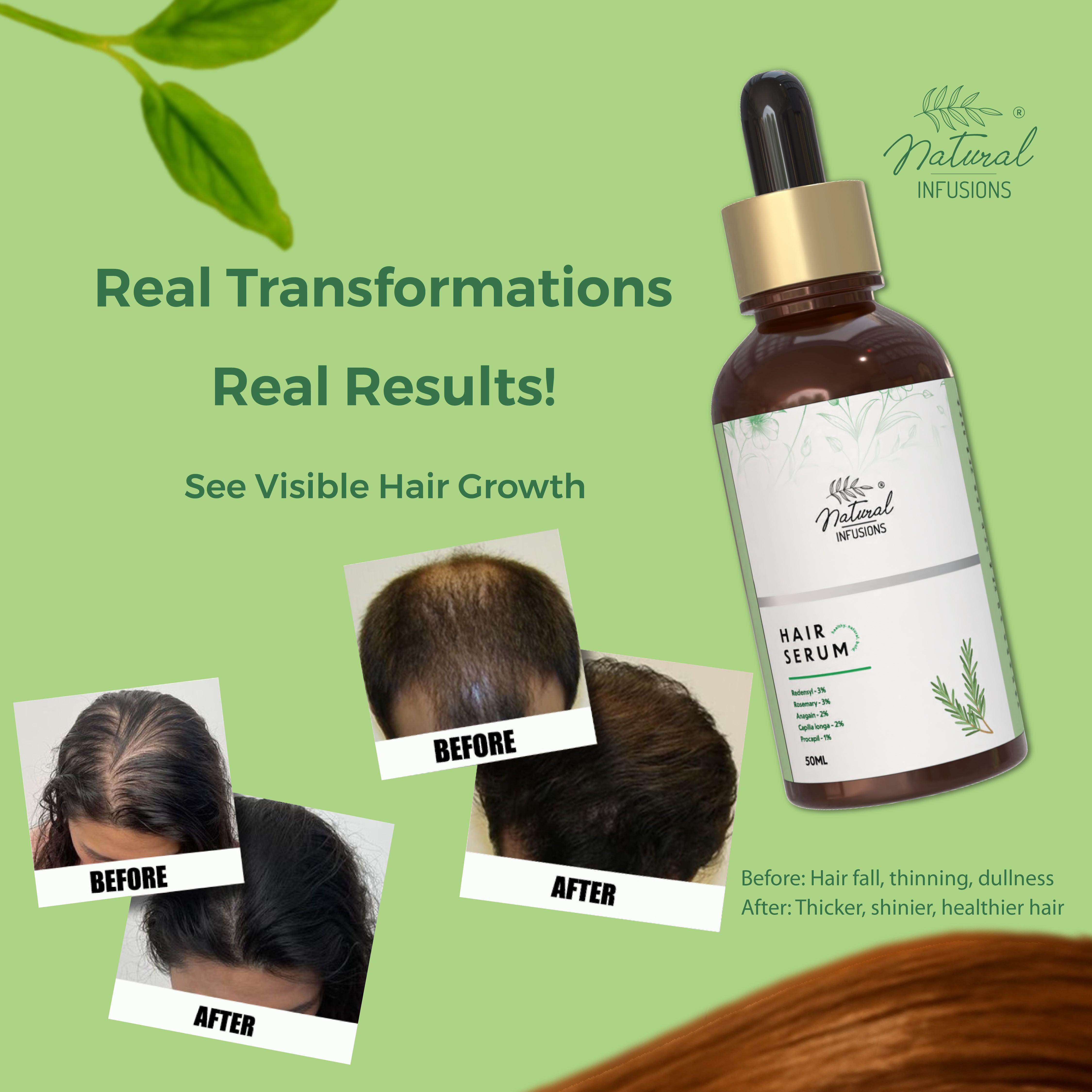 Hair Growth Serum with 3% Redensyl, 2% Anagain